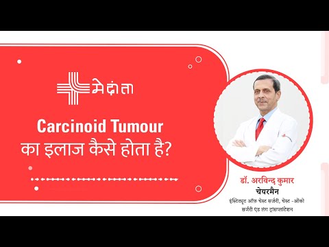  How is Carcinoid Tumour Treated? 